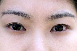 新潟市にあるひまわり鍼灸整骨院の腰痛治療