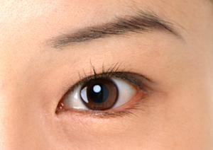 目に関するあらゆる悩みを相談出来ます